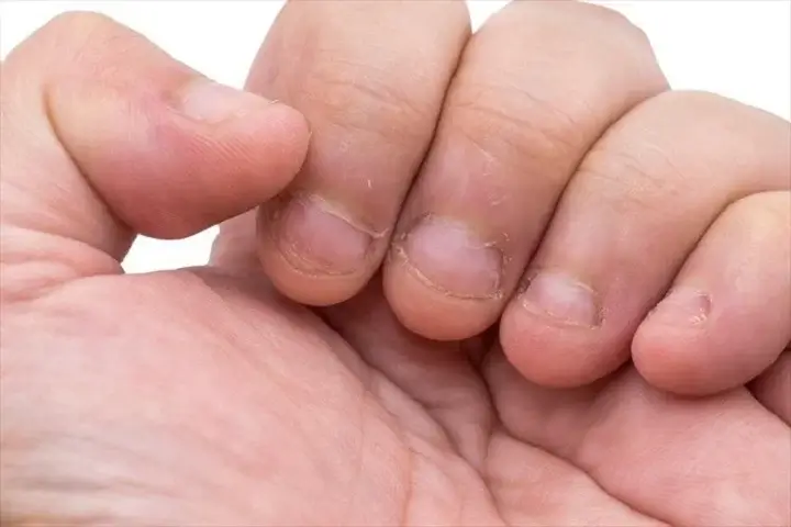 تغییر رنگ ناخن